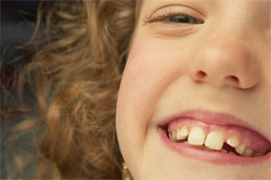 Speech Therapy at Liberty Speech Pathology Adelaide